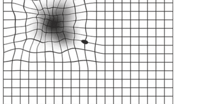 Understanding Age-Related Macular Degeneration (AMD) and Its Connection to Hypertension